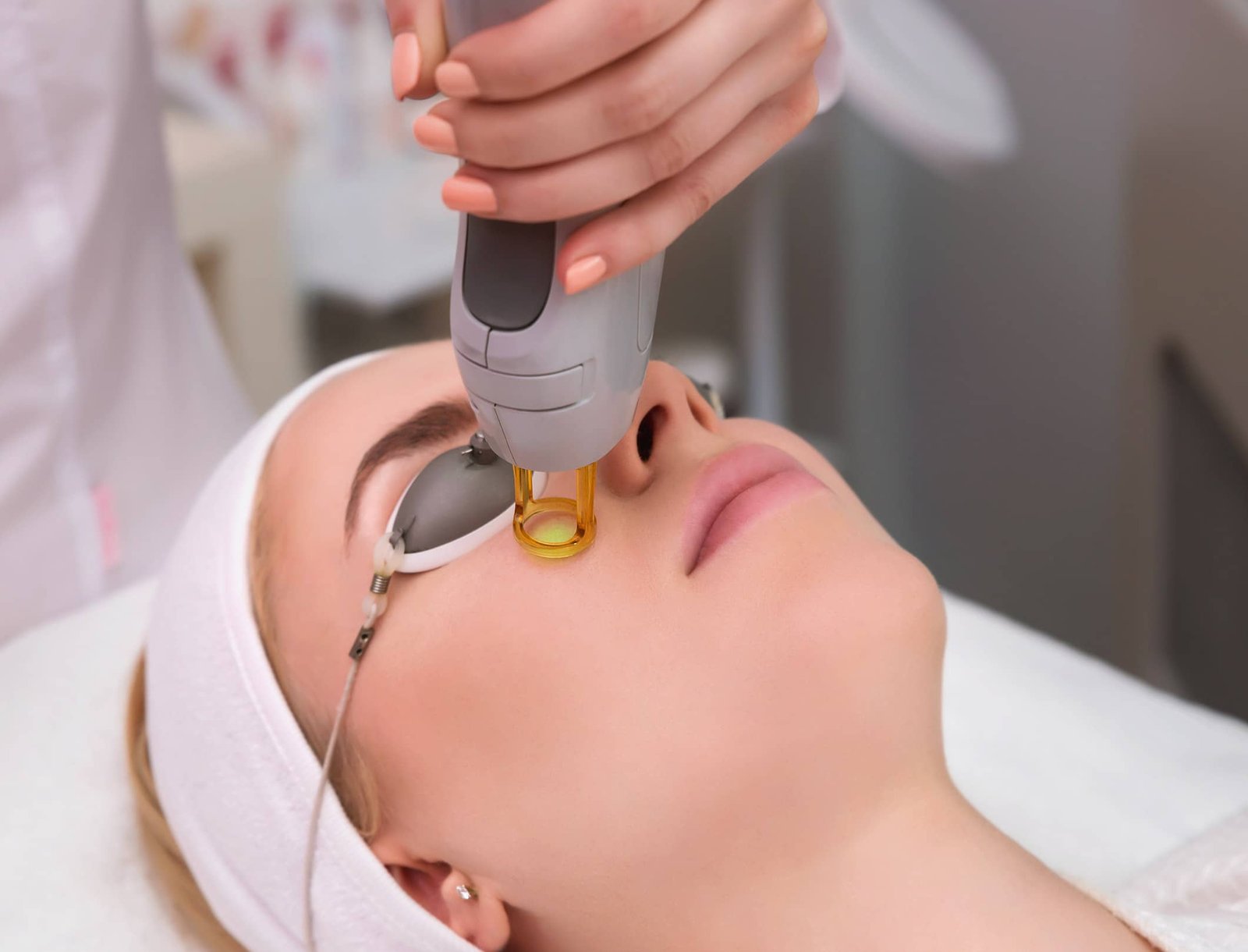 Une femme allongée sur une table de soins, recevant un traitement d'epilation laser sur le visage. Elle porte des protections oculaires et un professionnel utilise un appareil laser.