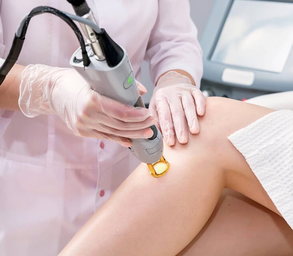 Un professionnel utilisant un dispositif d'epilation laser sur une jambe pendant un traitement. Les gants de protection sont visibles, et des équipements médicaux sont en arrière-plan.