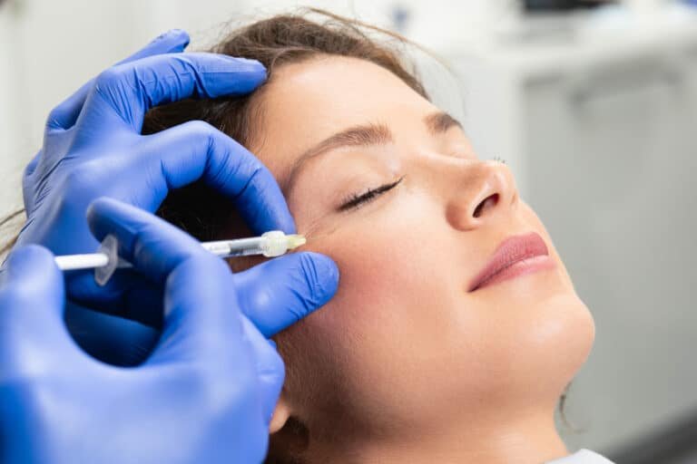 Injection de Botox au niveau des pattes d’oie pour atténuer les rides du contour des yeux