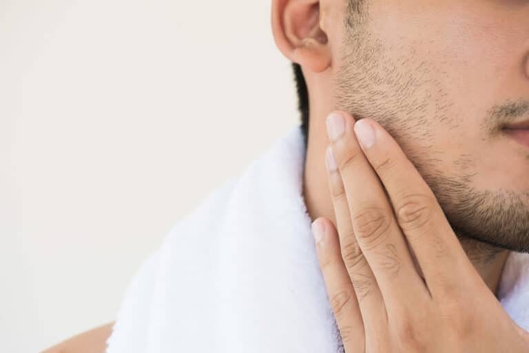 Épilation laser barbe homme visage traitement définitif en centre esthétique à Paris
