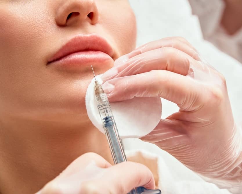 Quels sont les bons gestes à adopter après une injection levre acide hyaluronique ? | Centre du Champ de Mars | Paris