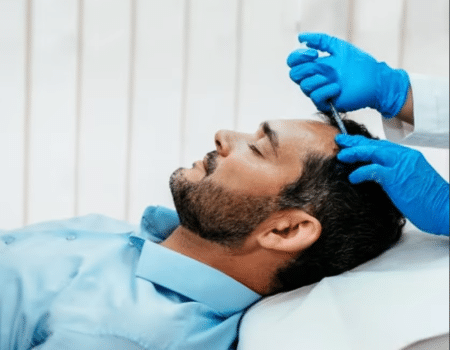 Revitalisation Naturelle des Cheveux : Tout sur le traitement PRP capillaire