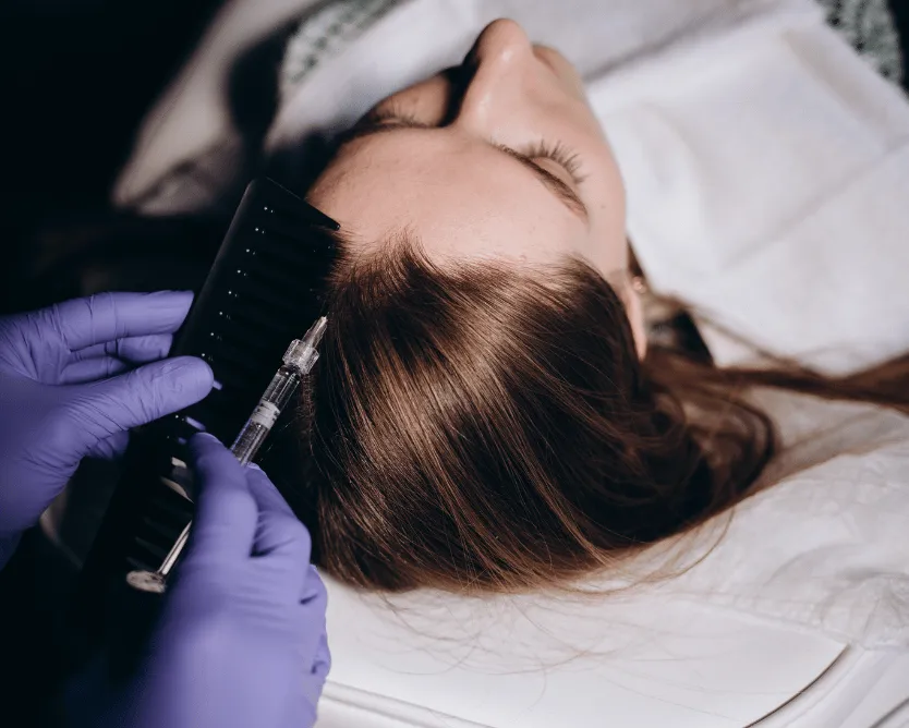 Révolution Capillaire : La Revitalisation Capillaire avec les Injections PRP au Centre du Champ de Mars