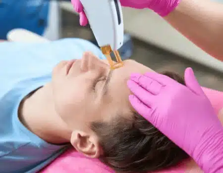 Laser visage homme anti-âge réduction rides et imperfections institut esthétique Paris