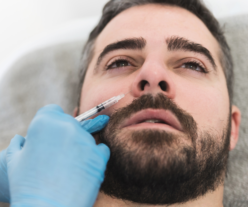 Rhinoplastie médicale par injection d’acide hyaluronique dans le nez d’un patient homme