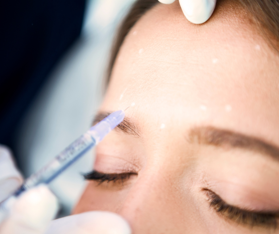 Médecin préparant une injection de Botox pour traiter la ride du lion sur le front