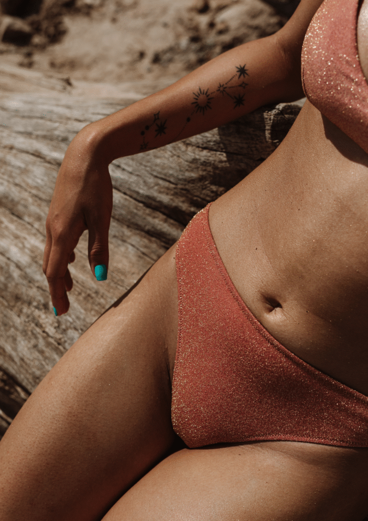 Résultat après épilation laser du maillot sur peau bronzée