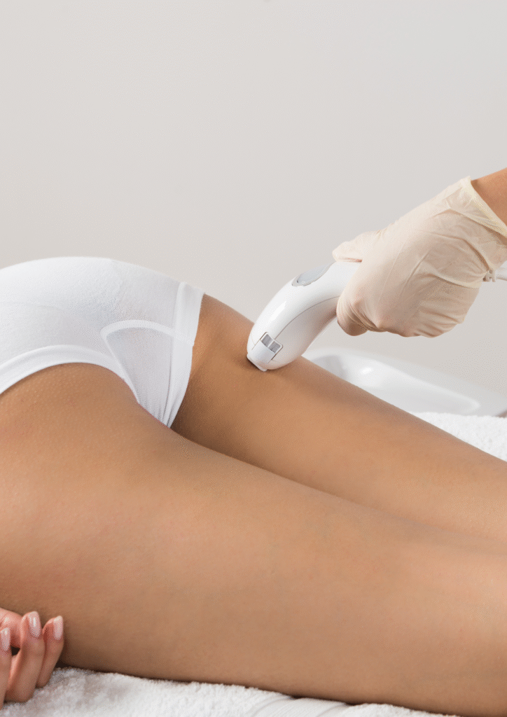 Séance d’épilation laser du sillon inter-fessier réalisée par une praticienne en institut.