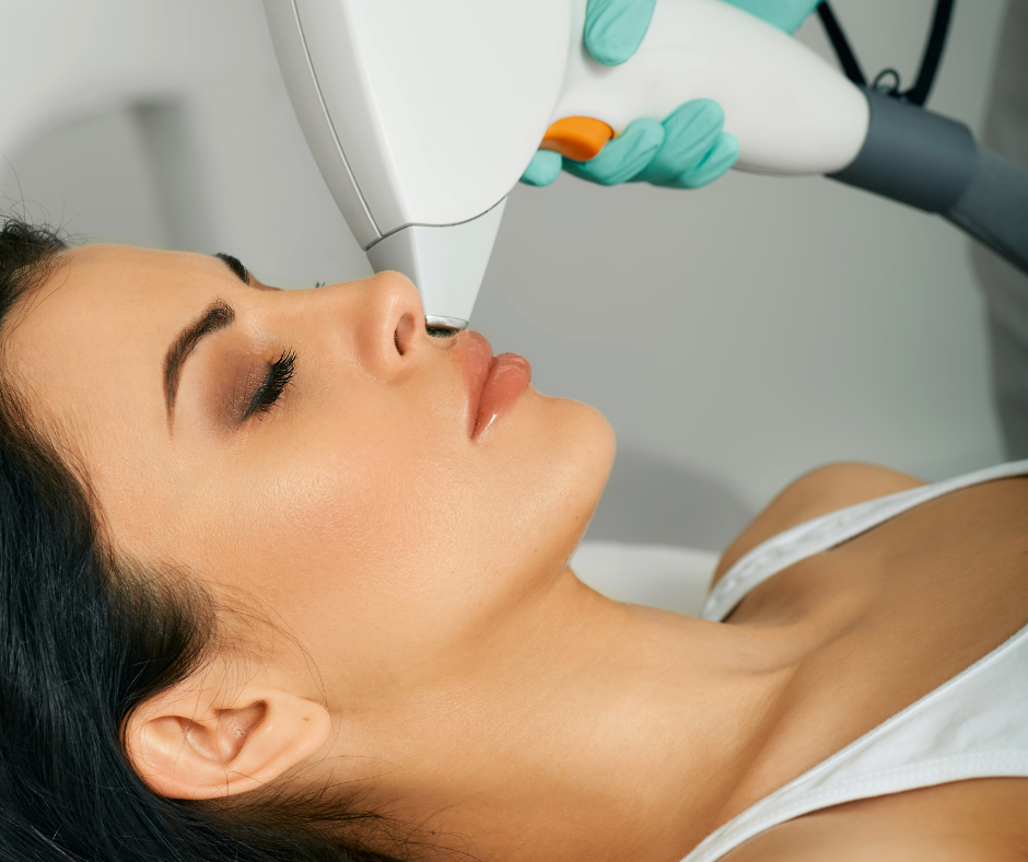Épilation laser visage femme lèvre – réduction durable des poils Paris 7