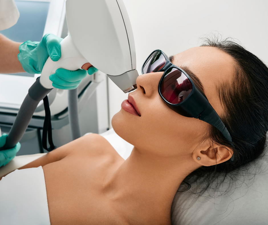 Épilation laser visage – destruction du follicule pileux traitement esthétique Paris