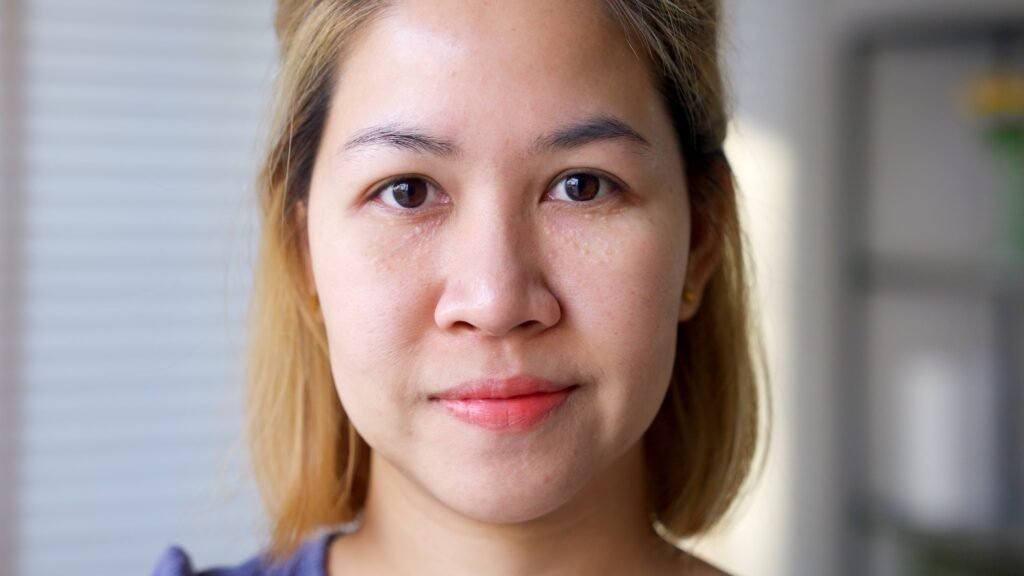 Portrait d’une femme présentant de petits grains de milium blancs autour des yeux et sur les joues