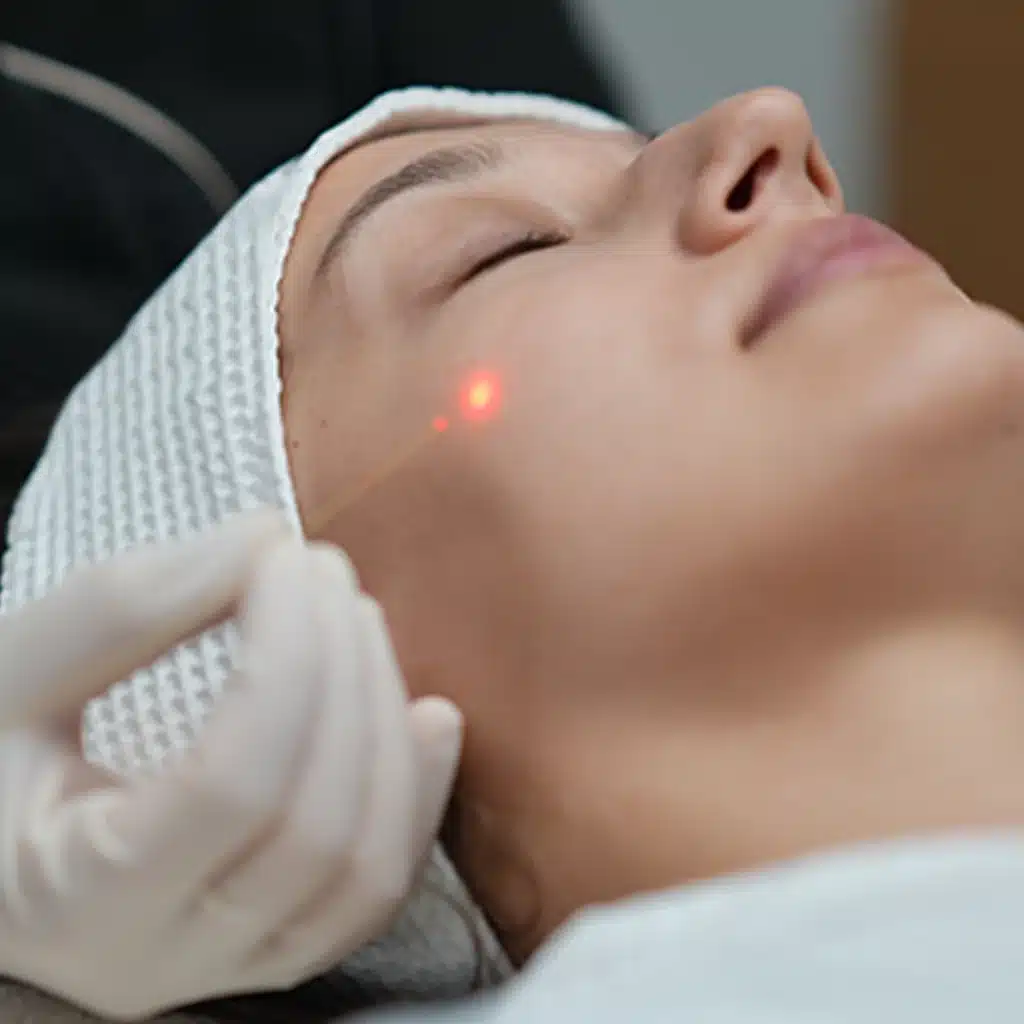 What is Endolift Laser Treatment