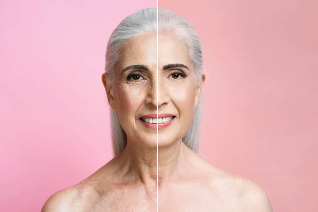 before after portrait mature woman