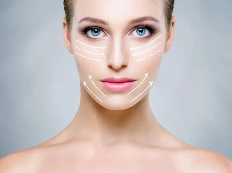 endolift paris