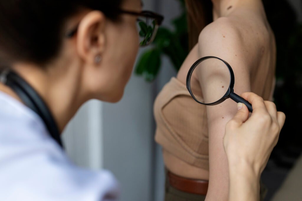 Dermatologue examinant un grain de beauté à la loupe lors d’une consultation de dépistage dermatologique à Paris