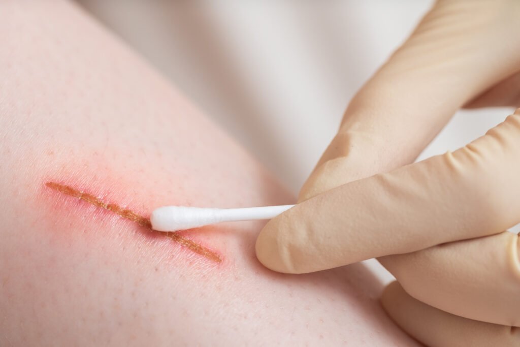 une assistante medicale change le pansement d une plaie aux urgences