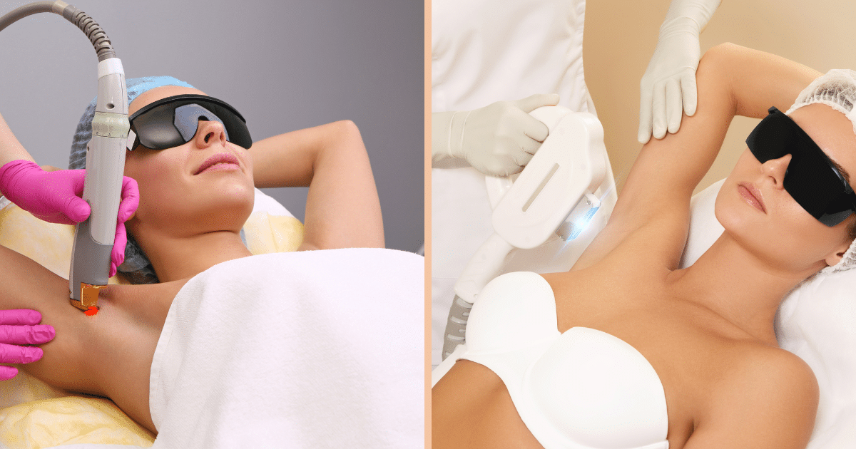 Comparaison entre un laser médical et un appareil de lumière pulsée (IPL) utilisés pour l’épilation en centre médical à Paris
