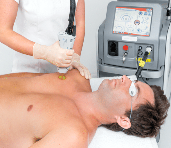 Séance d’épilation au laser médical ciblant le follicule pileux en environnement clinique