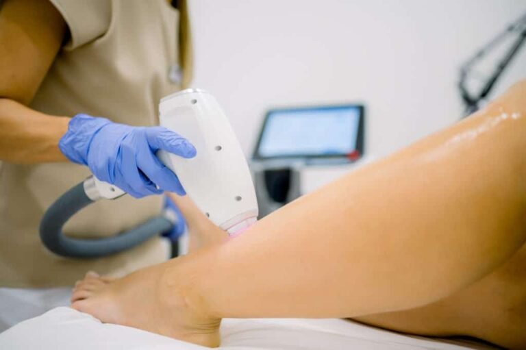 Épilation à la lumière pulsée (IPL) réalisée en centre médical à Paris