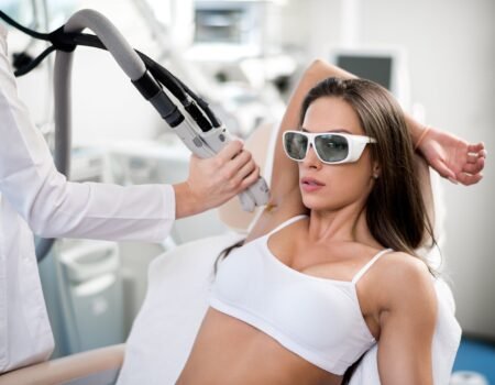 Épilation laser médicale des aisselles réalisée par un médecin au Centre du Champ de Mars à Paris, traitement sécurisé en cabinet esthétique.