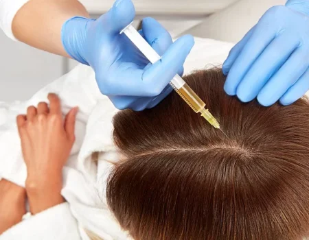 Injection de PRP visage chez une femme dans un centre de médecine esthétique à Paris, traitement naturel par plasma riche en plaquettes pour régénération de la peau.