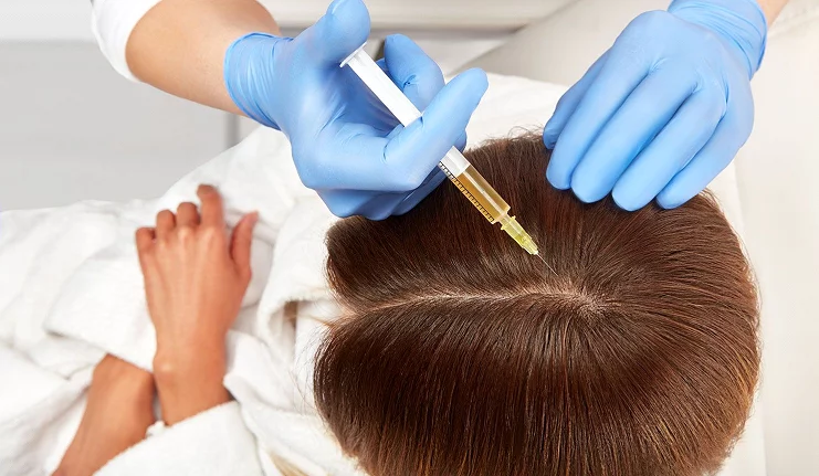 Injection de PRP visage chez une femme dans un centre de médecine esthétique à Paris, traitement naturel par plasma riche en plaquettes pour régénération de la peau.
